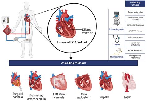 lv unloading ecmo|venoarterial ecmo lv unloading.